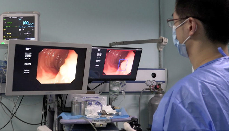 تشخیص ضایعه کولونوسکوپی با هوش مصنوعی