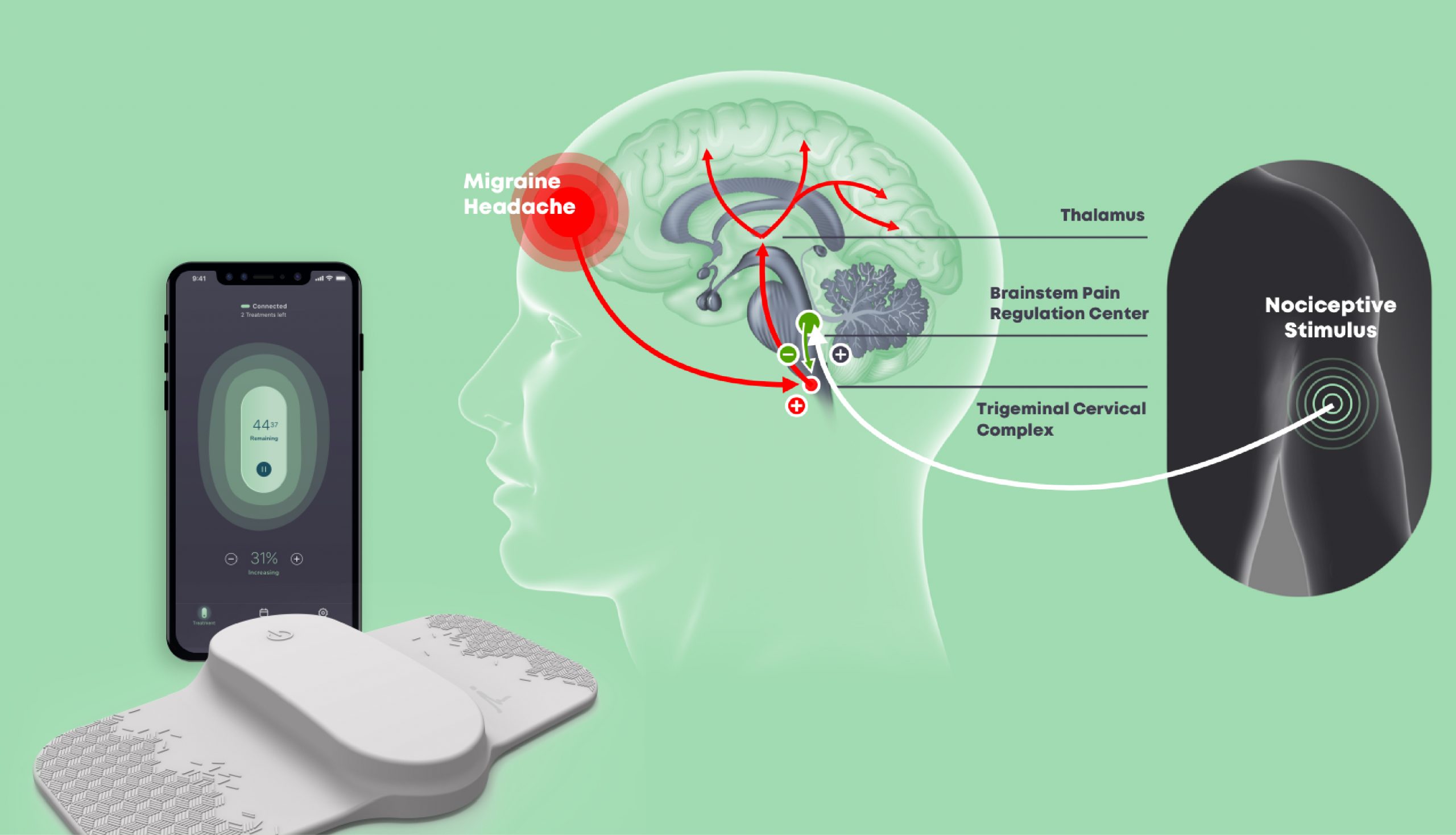 کنترل میگرن