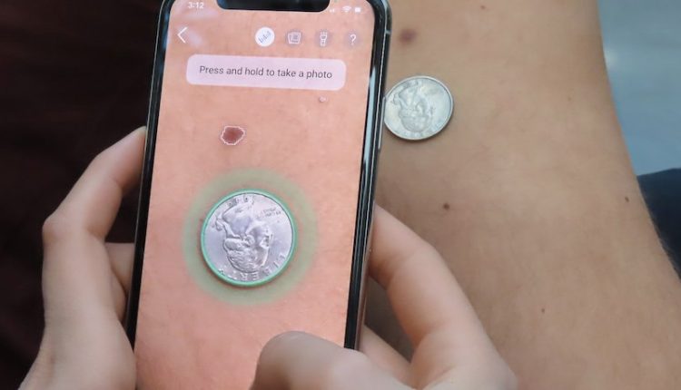 ضایعات پوستی